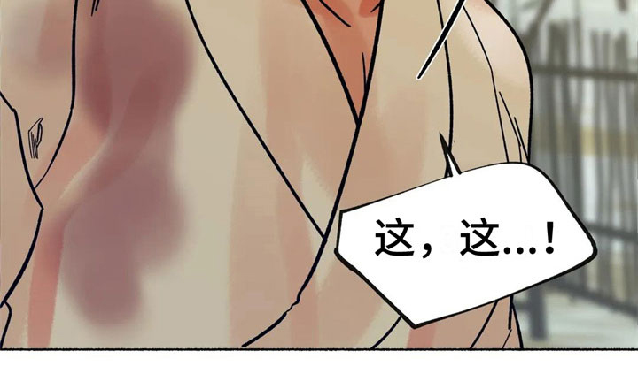 第17话11
